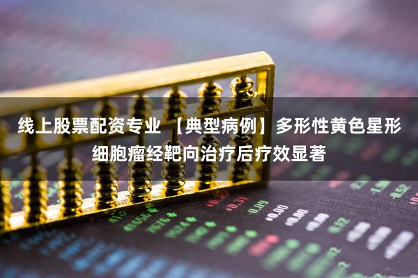 线上股票配资专业 【典型病例】多形性黄色星形细胞瘤经靶向治疗后疗效显著